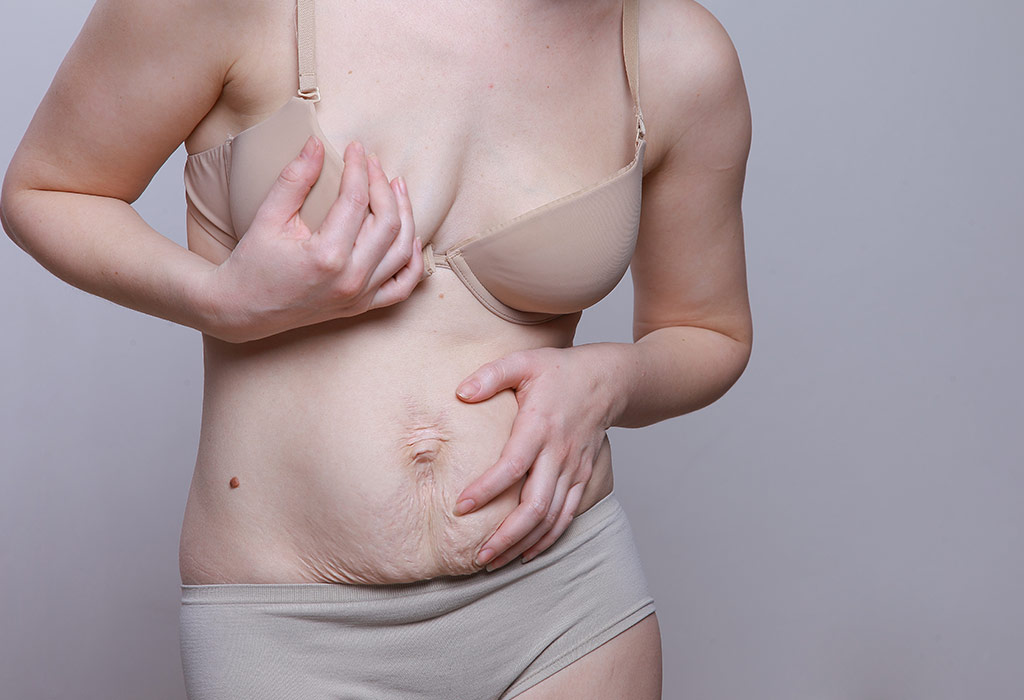diastasis pour savoir