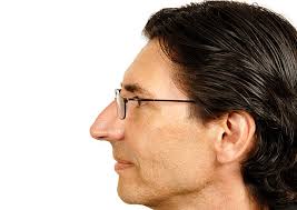 Profil gauche - avant rhinoplastie