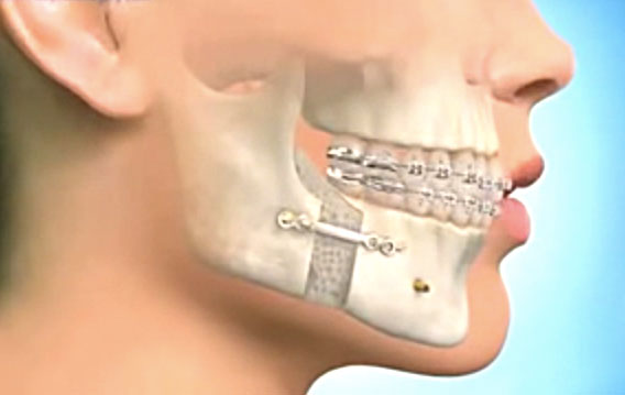 chirurgie orthodontie tunisie