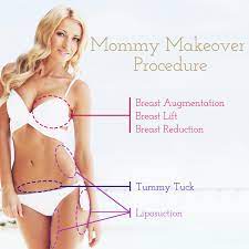 mommy makeover opérations incluses
