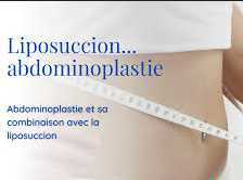 faire liposuccion et abdominoplastie