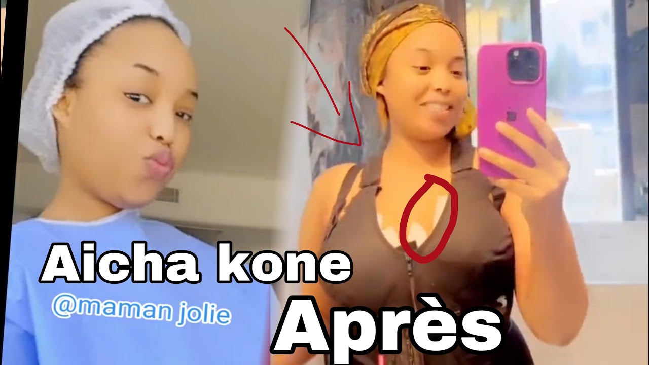 Chirurgie esthétique Tunisie