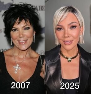 deep plane facelift kris jenner stars