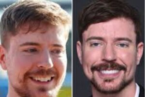 Mister beats facettes dentaires resultat avant après