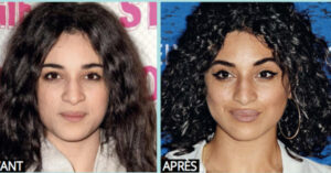 Camelia jordana chirurgie esthetique