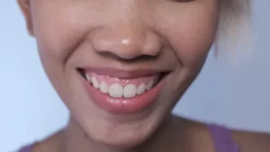 morphologie nez large