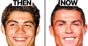 Ronaldo rhinoplastie et chirurgie esthétique