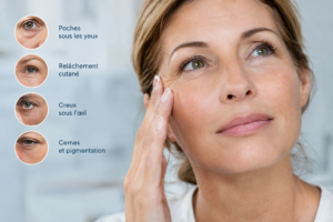 poches sous les yeux solutions