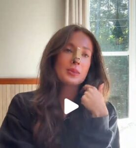Solene Lucas chirurgie esthétique nez 