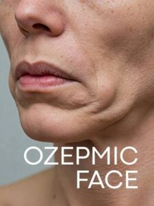 ozempic face quelle chirurgie 