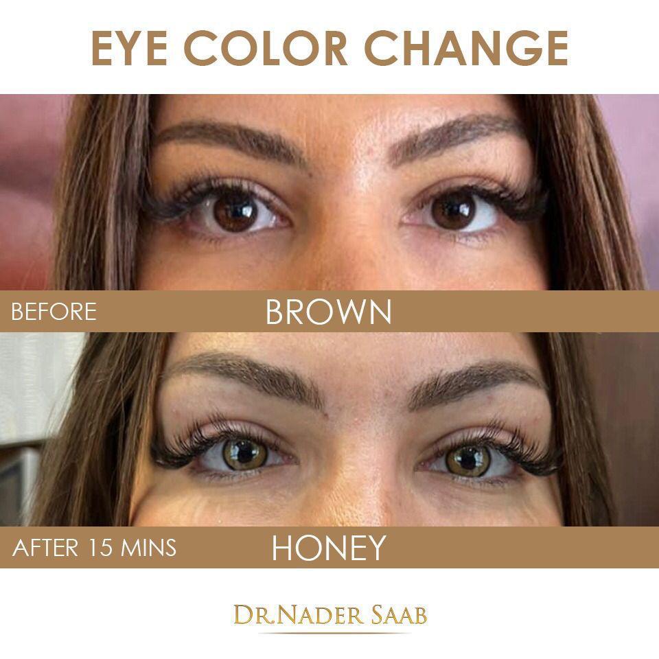eye-change-color-dubai