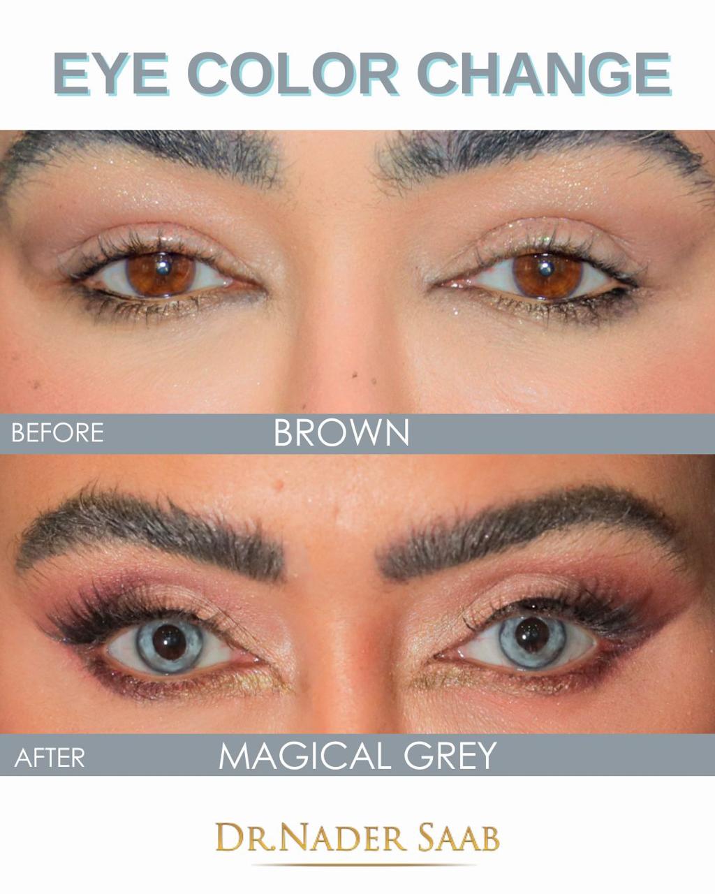 eye-change-color-dubai