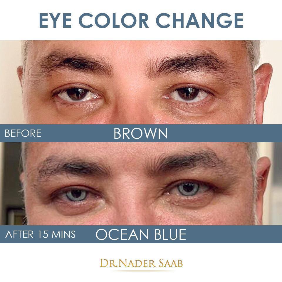 eye-change-color-dubai