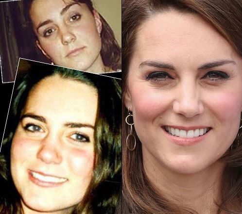 perfect nose kate Middleton