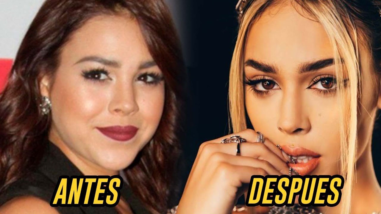 Danna Paola después de rinoplastia femenina