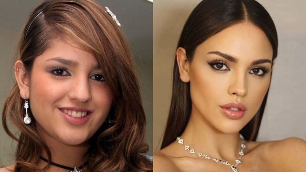 Eiza Gonzalez antes y después de la rinoplastia