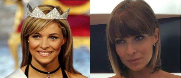 cristina chiabotto iera e oggi rinoplastica